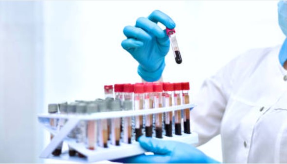 Hematología